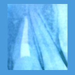 endodoncia