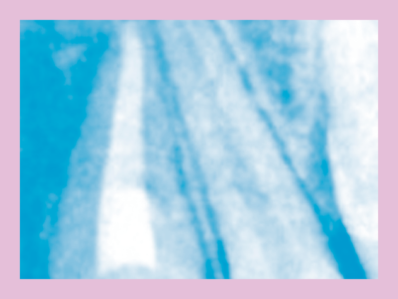 endodoncia