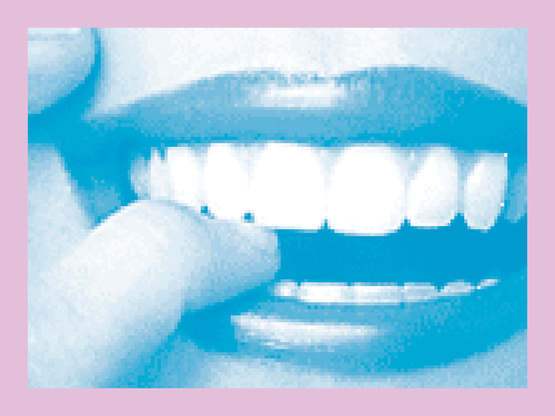 estetica dental