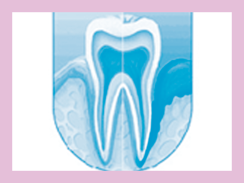 periodoncia