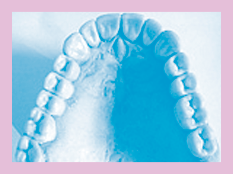 rehabilitacion oral