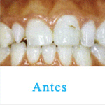 estética dental