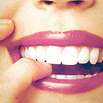 estética dental