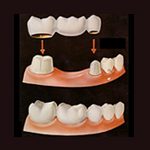 Rehabilitación oral